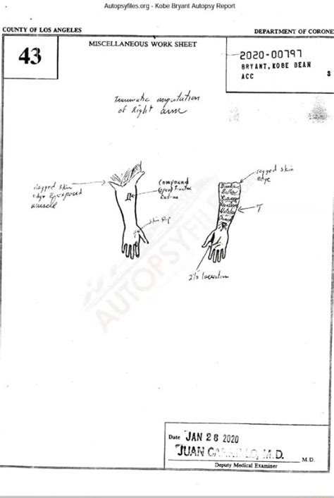 kobe bryanr autopsy|Autopsyfiles.org